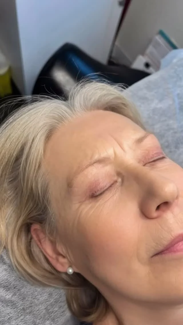 ~Stages of Microblading~

Picture 1~Before any Microblading 
Picture 2~ 8 weeks after her initial session post healing 
Picture 3~Immediately after perfecting touch up. 

What is Microblading? 

5 Facts About Microblading You Should Know😘

1️⃣ Semi-Permanent Results
Microblading creates hair-like strokes to mimic natural eyebrows. Results typically last 1-3 years, depending on your skin type and aftercare.

2️⃣ Customizable for Every Face
Your artist will design brows to complement your face shape, natural features, and personal preferences for a flawless, tailored look.

3️⃣ Not the Same as Tattooing
Unlike traditional tattoos, microblading uses a manual tool and pigment designed to fade naturally over time, giving a more natural appearance.

4️⃣ Requires Maintenance
To keep your brows fresh, touch-ups are recommended every 12-18 months, depending on how well the pigment holds on your skin.

5️⃣ Healing Time Is Key
The healing process takes about 7-14 days. Proper aftercare, like avoiding water and makeup on the brows, ensures the best results.

✨ Perfect brows are just a session away! ✨

www.iLashU.ca 
#microblading #naturalbeauty #yycmicroblading