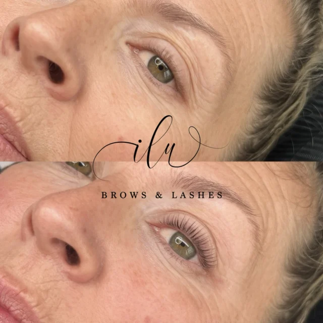 ~Eco Lash Lift + Tint~

Seriously this product gives the most beautiful natural results and I’m here for it. So many woman are moving towards the clean, natural beauty era and I’m loving 🥰 it! 

This service is good for pretty much anyone, long straight lashes, woman who have shorter lashes and really blonde lashes. Those who can’t get extensions anymore, teenagers etc. The list goes on and on! Contact me today if you’d like book your low maintenance beauty must have today!

#yyclashlift #yyccleanbeauty #lashlift
