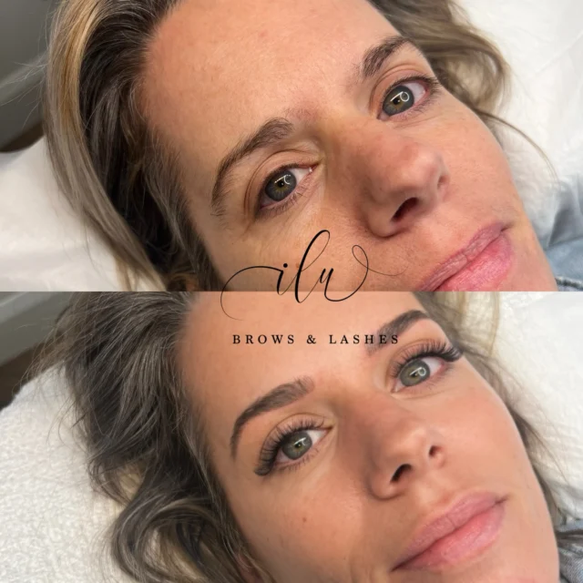 ~Microblading +Light Volume Extensions~ 

✨ What a dramatic difference! ✨

Microblading + lash extensions = instant definition, lift, and confidence 🙌
The brows create shape, symmetry, and fullness where it’s needed most, while lash extensions open up the eyes and add that effortless, “always put together” look.

No more filling in brows. No more mascara. Just waking up looking refreshed, polished, and glowing. 

Proof that small enhancements can make a big impact 💫

#Microblading #LashExtensions #BrowsAndLashes #BeforeAndAfter #DramaticDifference WakeUpBeautiful